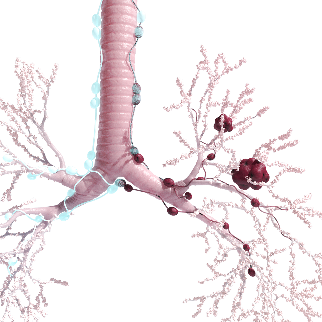 Lung Cancer App